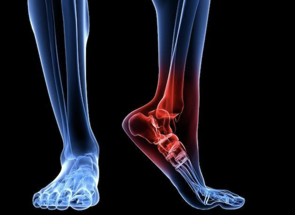 Wound Care Rochester Hills, MI